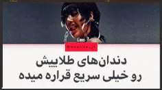 کاورم از اهنگ ☆ROCK STAR ☆🥲🤧💞🐣زیاد خوب نشد 