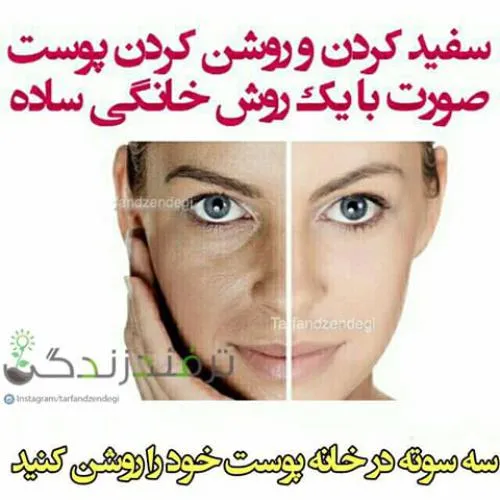 راهای سفید شدن پوست تمام نقاط صورت و بدن ***