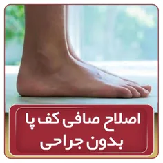 اصلاح صافی کف پا بدون جراحی 