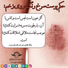 💠حکم پوست سرخ رنگی که بعد از شستن زخم