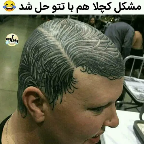 😂 😂 کچلا به صف بشن