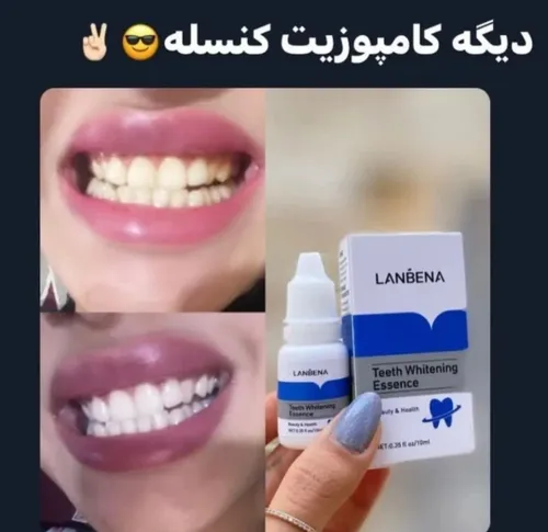 تاحالا شده زرد شدن دندان هات آزارت بده ؟🥲