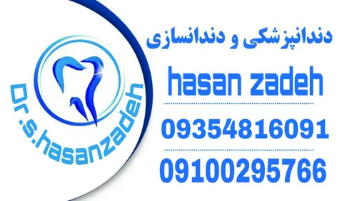 ونیز کامپوزیت.لامینت.روکش.