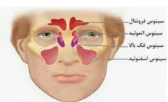 علایم گرفتگی بینی