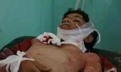 💢 روز خونین برای روزه‌داران یمنی؛ 8 کشته و 29 زخمی