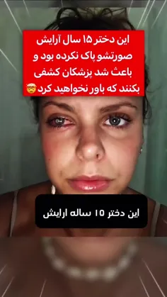 عوارض پاک نکردن  آرایشی صورت😶😟