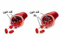 ۶ نشانه که می گویند قند خون تان بالا است حتی اگر دیابت ند