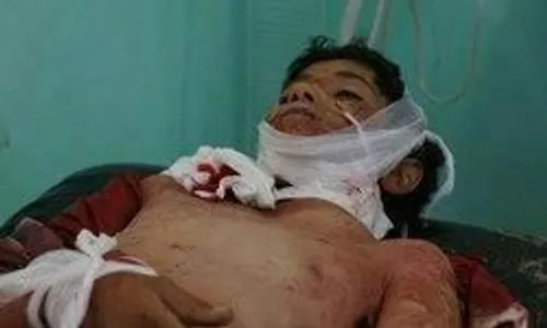 💢 روز خونین برای روزه داران یمنی؛ 8 کشته و 29 زخمی