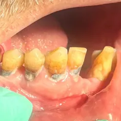 #دندان #دندان_پزشکی #دندان_پزشک #درد_دندان