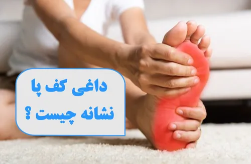 داغی کف نشان دهنده چیست؟ علل و درمان