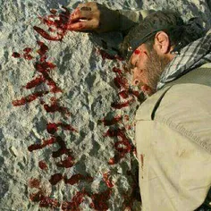 یکی از شهیدان حزب الله لبنان لحظاتی  پیش از شهادت با خون 