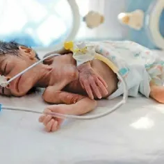 🔴 تاثیر تحریم‌های سعودی بر نوزادان یمنی