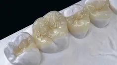 دندان زیبا