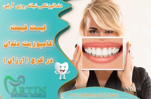 لیست قیمت کامپوزیت دندان در کرج ( ارزان و با کیفیت )