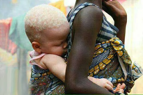 پدیده ای عجیب و نادر در افریقا،تولد نوزادی سفید پوست و زا