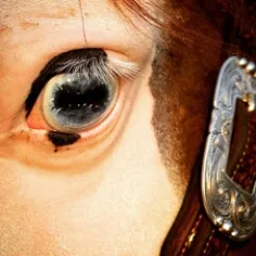 چشم اسب