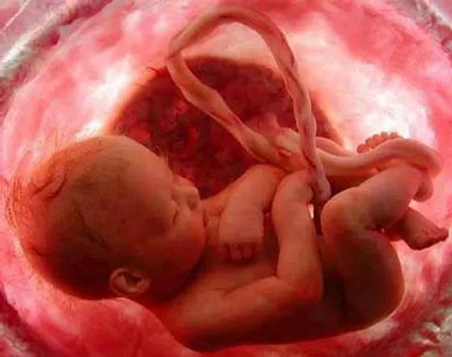 عکس کمتر دیده شده از 9 ماهگی جنین در شکم مادر