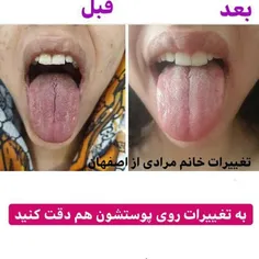 *نتیجه_مشتری* 