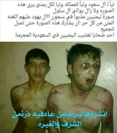 ♦️تصویر منتشر شده از وضعیت زندانیان‌ یمنی در زندان های آل