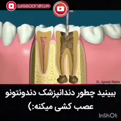 ببینید چطور دندانپزشک دندونتونو 