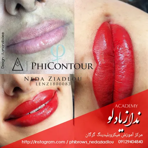 میکروبلیدینگ و میکروپیگمنتیشن گرگان ندا زیادلو 0912940484