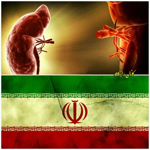 ایران تنها کشوری است که فروش کلیه انسان ها قانونی میباشد.