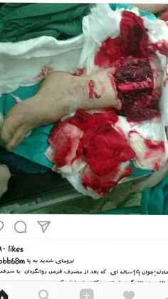 کسی که دلشو نداره نگاههه نکنید لطفان حادثه امروز یارو شیش