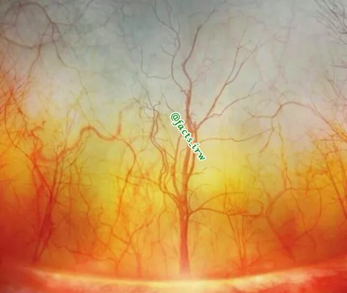 این یک تابلوی نقاشی نیست! بلکه تصویری کلوز آپ از رگ های خ