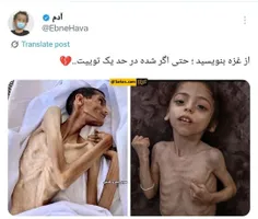 ⚠️معیار انسانیت این روزها مسئله غزه است