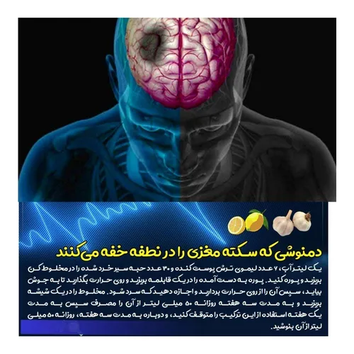 تهیه دمنوشی که سکته مغزی را در نطفه خفه می کنند