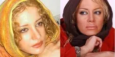 بازیگران ایرانی قبل از عمل و بعد از عمل