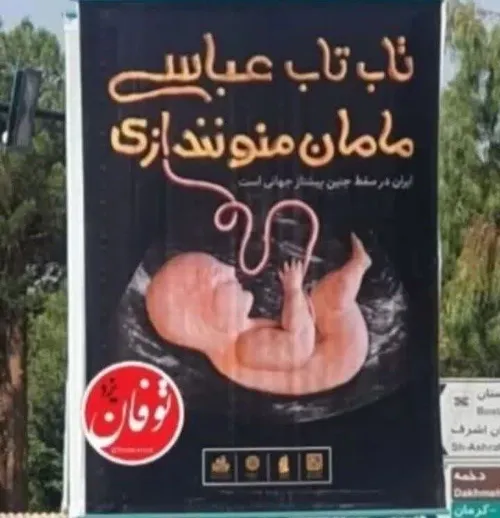 📌 سونوگرافی نکن، نُخبه جمع کن!