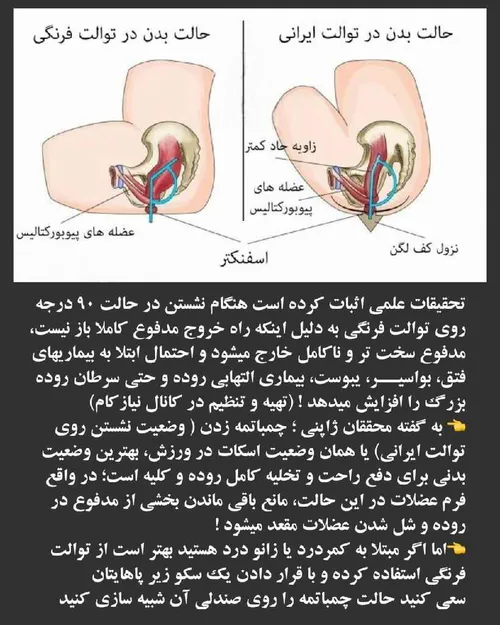 توالت فرنگی یا توالت ایرانی ؛ کدام یک برای سلامت شما بهتر