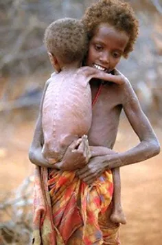 اینجا سومالیاست... به اندام کودک کوچکتر توجه کنید×