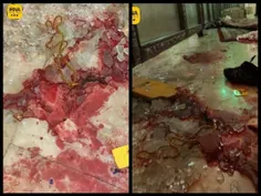 🔞 تصاویری از خون شهدای امروز حادثه تروریستی حمله به حرم ش