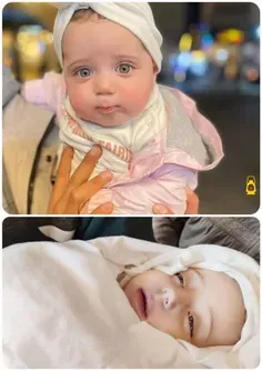 این دخترکوچولوی زیبا، «سیدرا أیمن مطر» دیروز در بمباران‌ه