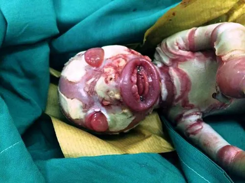 تولد نوزادی وحشت ناک در بیمارستانی در شیراز