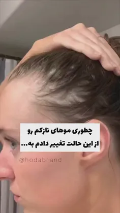 چطوری موهای نازکم رو درمان کنم؟!جهت اطلاعات عمومی***