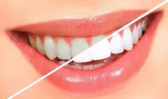 🚺 اگر می خواهید #دندانهایی_سفیدتر داشته باشید، غرغره کردن