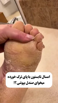 ترک پا