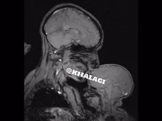 عکس MRI مادر و فرزند