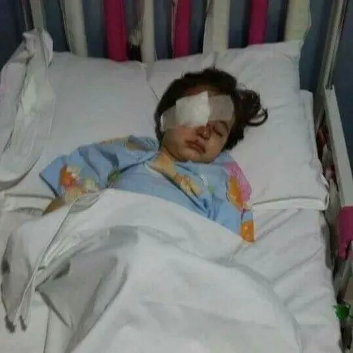 کودک زخمی شده درانفجارات دیشب