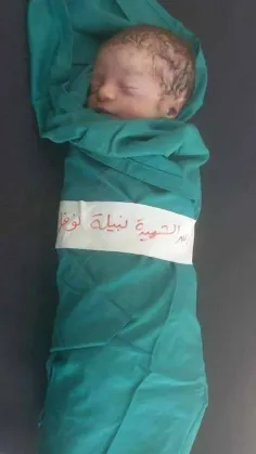 #کوچکترین شهید نوار غزه نبیله نوفل تنها ۷ روز سن دارد!!!