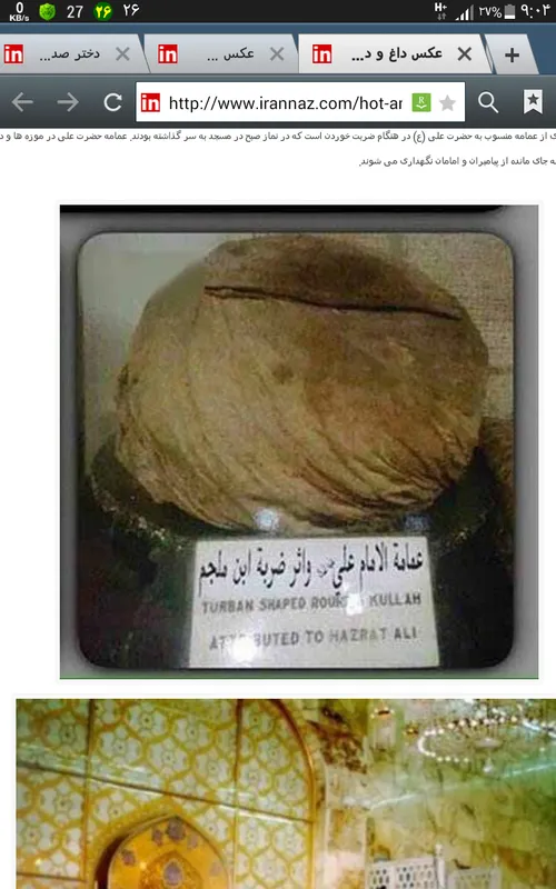 امام حضرت علی هنگام ضربت خوردن در موزه