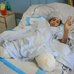 تصویری تکان دهنده از دختر ۱۱ ساله فلسطینی که هر دو پا و ی