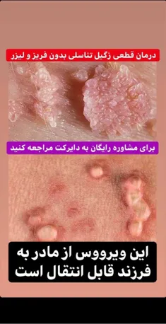 بیماریه HPV درمان قطعی‌ مراقب شریک جنسی خود باشید این بیم