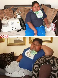 📸  این پسر آفریقایی، ۹۰ کیلو وزن دارد