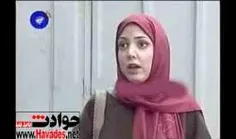 سالومه قبل از عمل