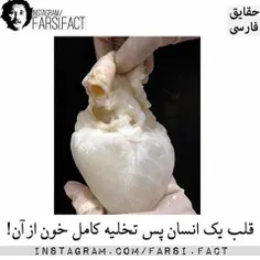 قلب یک انسان پس از تخلیه کامل خون