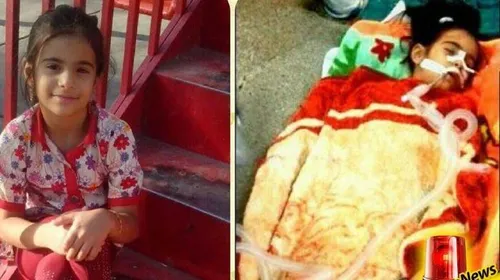 قصور پزشکی در گلستان دختر 8 ساله را به کما برد
